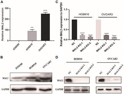 Multi-Omics Analysis of the Therapeutic Value of MAL2 Based on Data Mining in Human Cancers